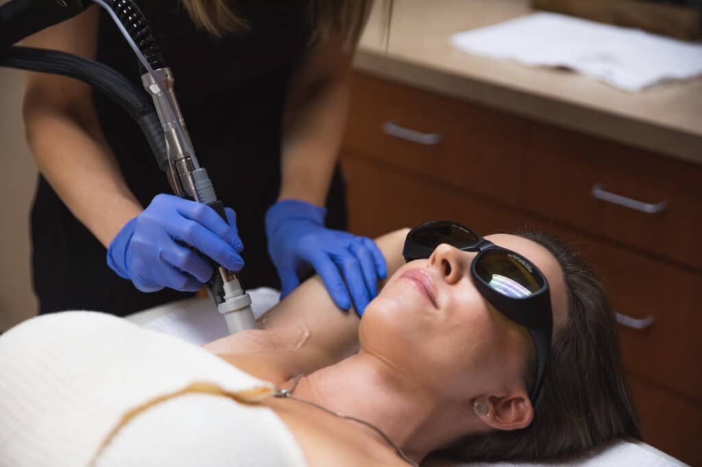 Laser Hair Removal