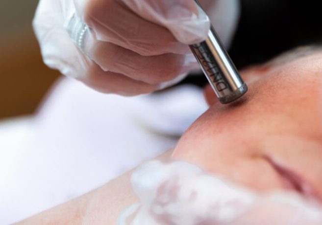 Microdermabrasion